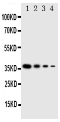 Anti-NTAL antibody, PA2039, Western blotting Recombinant Protein Detection Source: E.coli derived -recombinant Human LAT2, 37.8KD