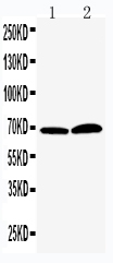 Anti-PADI4/PAD4 antibody, PA2043, Western blotting Lane 1: PANC Cell Lysate Lane 2: 293T Cell Lysate