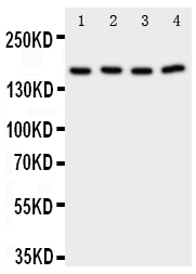 Anti-PLA2G4A antibody, PA2047, Western blotting Lane 1: Rat Testis Tissue Lysate Lane 2: Rat Brain Tissue Lysate Lane 3: A549 Cell Lysate Lane 4: COLO320 Cell Lysate