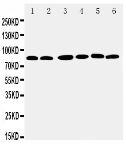 Anti-RSK1 p90 antibody, PA2052, Western blotting Lane 1: MCF-7 Cell Lysate Lane 2: HELA Cell Lysate Lane 3: K562 Cell Lysate Lane 4: JURKAT Cell Lysate Lane 5: SW620 Cell Lysate Lane 6: RAJI Cell Lysate