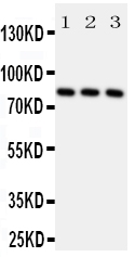 Anti-RSK1 p90 antibody, PA2052, All Western blotting All lanes: Anti-RPS6KA1 (PA2052) at 0.5ug/ml