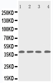 Anti-p53R2 antibody, PA2053, Western blotting Lane 1: Rat Thymus Tissue Lysate Lane 2: MCF-7 Cell Lysate Lane 3: A431 Cell Lysate Lane 4: HELA Cell Lysate