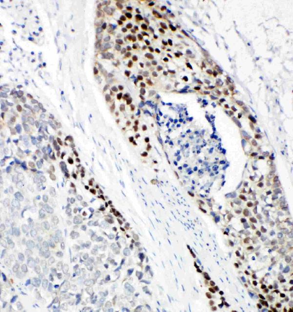 IHC analysis of p63 using anti-p63 antibody (PA2056).