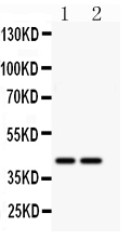 Anti-CD244 antibody, PA2057, Western blotting All lanes: Anti CD244 (PA2057) at 0.5ug/ml Lane 1: MCF-7 Whole Cell Lysate at 40ug Lane 2: HELA Whole Cell Lysate at 40ug Predicted bind size: 42KD Observed bind size: 42KD