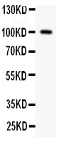 Anti-F2 antibody, PA2059, Western blotting All lanes: Anti F2 (PA2059) at 0.5ug/ml WB : Rat Testis Tissue Lysate at 50ug Predicted bind size: 70KD Observed bind size: 100KD