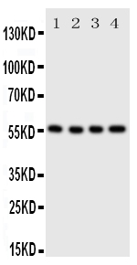 Anti-SLC2A5 antibody, PA2064, Western blotting Lane 1: U87 Cell Lysate Lane 2: 293T Cell Lysate Lane 3: HT1080 Cell Lysate Lane 4: SW620 Cell Lysate