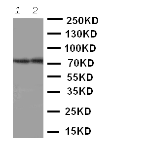 Anti-ABCG4 antibody, PA2067, Western blotting Lane 1: Rat Brain Tissue Lysate Lane 2: Mouse Brain Tissue Lysate