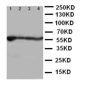 Anti-ALDH2 antibody, PA2073, Western blotting Lane 1: Rat Liver Tissue Lysate Lane 2: Rat Intestine Tissue Lysate Lane 3: Rat Lung Tissue Lysate Lane 4: Rat Kidney Tissue Lysate