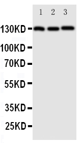 Anti-VE Cadherin antibody, PA2079, Western blotting All lanes: Anti VE Cadherin (PA2079) at 0.5ug/ml