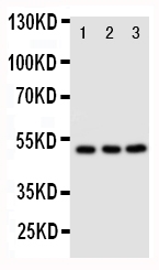 Anti-CXCR4 antibody, PA2081, Western blotting Lane 1: M231 Cell Lysate Lane 2: MCF-7 Cell Lysate Lane 3: JURKAT Cell Lysate