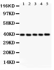 Anti-CXCR6 antibody, PA2082-1, Western blotting All lanes: Anti CXCR6 (PA2082-1) at 0.5ug/ml Lane 1: Rat Brain Tissue Lysate at 50ug Lane 2: Rat Testis Tissue Lysate at 50ug Lane 3: Rat Spleen Tissue Lysate at 50ug Lane 4: Mouse Brain Tissue Lysate at 50ug Lane 5: Mouse Testis Tissue Lysate at 50ug Predicted bind size: 39KD Observed bind size: 39KD