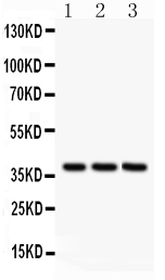 Anti-Bonzo antibody, PA2082, Western blotting All lanes: Anti Bonzo (PA2082) at 0.5ug/ml Lane 1: HELA Whole Cell Lysate at 40ug Lane 2: JURKAT Whole Cell Lysate at 40ug Lane 3: MCF-7 Whole Cell Lysate at 40ug Predicted bind size: 39KD Observed bind size: 39KD