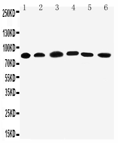 Western blot analysis of PC1/3/PCSK1 using anti-PC1/3/PCSK1 antibody (PA2084). Electrophoresis was performed on a 5-20% SDS-PAGE gel at 70V (Stacking gel) / 90V (Resolving gel) for 2-3 hours. The sample well of each lane was loaded with 50ug of sample under reducing conditions. Lane 1: Rat Liver Tissue Lysate Lane 2: Rat Thymus Tissue Lysate Lane 3: A549 Cell Lysate Lane 4: HELA Cell Lysate Lane 5: COLO320 Cell Lysate Lane 6: PANC Cell Lysate After Electrophoresis, proteins were transferred to a Nitrocellulose membrane at 150mA for 50-90 minutes. Blocked the membrane with 5% Non-fat Milk/ TBS for 1.5 hour at RT. The membrane was incubated with rabbit anti-PC1/3/PCSK1 antigen affinity purified polyclonal antibody (Catalog # PA2084) at 0.5 μg/mL overnight at 4°C, then washed with TBS-0.1%Tween 3 times with 5 minutes each and probed with a goat anti-rabbit IgG-HRP secondary antibody at a dilution of 1:10000 for 1.5 hour at RT. The signal is developed using an Enhanced Chemiluminescent detection (ECL) kit (Catalog # EK1002) with Tanon 5200 system. A specific band was detected for PC1/3/PCSK1 at approximately 84KD. The expected band size for PC1/3/PCSK1 is at 84KD.