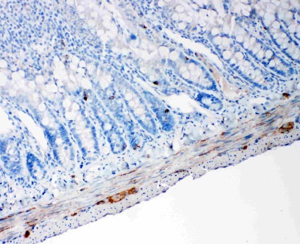 IHC analysis of PC1/3/PCSK1 using anti-PC1/3/PCSK1 antibody (PA2084). PC1/3/PCSK1 was detected in paraffin-embedded section of rat intestine tissues. Heat mediated antigen retrieval was performed in citrate buffer (pH6, epitope retrieval solution) for 20 mins. The tissue section was blocked with 10% goat serum. The tissue section was then incubated with 1μg/ml rabbit anti-PC1/3/PCSK1 Antibody (PA2084) overnight at 4°C. Biotinylated goat anti-rabbit IgG was used as secondary antibody and incubated for 30 minutes at 37°C. The tissue section was developed using Strepavidin-Biotin-Complex (SABC)(Catalog # SA1022) with DAB as the chromogen.