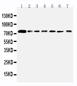 Anti-SPARCL1 antibody, PA2088, Western blotting Lane 1: Rat Lung Tissue Lysate Lane 2: Mouse Lung Tissue Lysate Lane 3: PANC Cell Lysate Lane 4: A549 Cell Lysate Lane 5: COLO320 Cell Lysate Lane 6: MCF-7 Cell Lysate Lane 7: HT1080 Cell Lysate