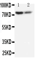 Anti-PMP70 antibody, PA2091, Western blotting Lane 1: Rat Lung Tissue Lysate Lane 2: Rat Ovary Tissue Lysate