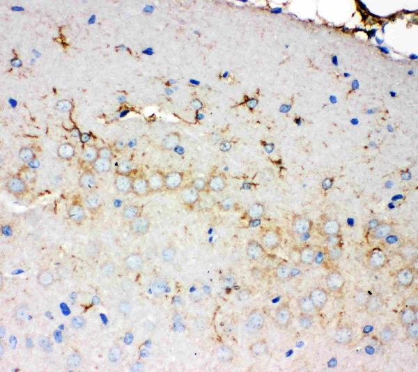 Anti-PMP70 antibody, PA2091, IHC(P) IHC(P): Rat Brain Tissue