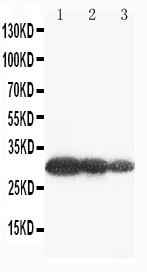 Anti-Aquaporin 6 antibody, PA2092, Western blotting Lane 1: U87 Cell Lysate Lane 2: COLO320 Cell Lysate Lane 3: MCF-7 Cell Lysate