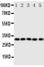 Anti-Aquaporin 9 antibody, PA2094, Western blotting All lanes: Anti Aquaporin 9 (PA2094) at 0.5ug/ml