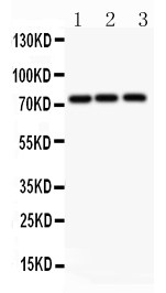 Anti-APLP1 antibody, PA2096, Western blotting All lanes: Anti APLP1 (PA2096) at 0.5ug/ml Lane 1: HELA Whole Cell Lysate at 40ug Lane 2: PC-12 Whole Cell Lysate at 40ug Lane 3: HEPA Whole Cell Lysate at 40ug Predicted bind size: 72KD Observed bind size: 72KD