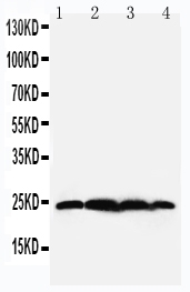 Anti-BAG2 antibody, PA2099, Western blotting Lane 1: Rat Testis Tissue Lysate Lane 2: HELA Cell Lysate Lane 3: A549 Cell Lysate Lane 4: A431 Cell Lysate