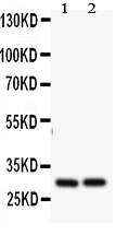 Anti-Bcl2A1 antibody, PA2102, Western blotting All lanes: Anti Bcl2A1(PA2102) at 0.5ug/ml Lane 1: HELA Whole Cell Lysate at 40ug Lane 2: JURKAT Whole Cell Lysate at 40ug Predicted bind size: 30KD Observed bind size: 30KD