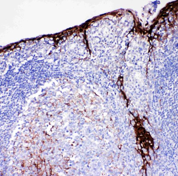 IHC analysis of Cystatin A/CSTA using anti-Cystatin A/CSTA antibody (PA2105). Cystatin A/CSTA was detected in paraffin-embedded section of human tonsil tissues. Heat mediated antigen retrieval was performed in citrate buffer (pH6, epitope retrieval solution) for 20 mins. The tissue section was blocked with 10% goat serum. The tissue section was then incubated with 1μg/ml rabbit anti-Cystatin A/CSTA Antibody (PA2105) overnight at 4°C. Biotinylated goat anti-rabbit IgG was used as secondary antibody and incubated for 30 minutes at 37°C. The tissue section was developed using Strepavidin-Biotin-Complex (SABC)(Catalog # SA1022) with DAB as the chromogen.