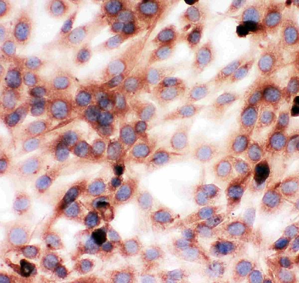 IHC analysis of Gelsolin/GSN using anti-Gelsolin/GSN antibody (PA2109). Gelsolin/GSN was detected in immunocytochemical section of NIH3T3 Cell. Enzyme antigen retrieval was performed using IHC enzyme antigen retrieval reagent (AR0022) for 15 mins. The cells were blocked with 10% goat serum. And then incubated with 1μg/ml rabbit anti-Gelsolin/GSN Antibody (PA2109) overnight at 4°C. Biotinylated goat anti-rabbit IgG was used as secondary antibody and incubated for 30 minutes at 37°C. The section was developed using Strepavidin-Biotin-Complex (SABC)(Catalog # SA1022) with DAB as the chromogen.