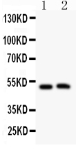 Anti-MIP antibody, PA2110, Western blotting All lanes: Anti MIP (PA2110) at 0.5ug/ml Lane 1: Mouse Spleen Tissue Lysate at 50ug Lane 2: Mouse Intestine Tissue Lysate at 50ug Predicted bind size: 28KD Observed bind size: 50KD