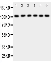 Anti-NFkB p105/p50 antibody, PA2111, Western blotting All lanes: Anti NFkB p105/p50 (PA2111) at 0.5ug/ml