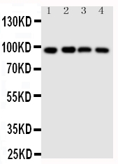 Anti-SIDT1 antibody, PA2113, Western blotting Lane 1: HELA Cell Lysate Lane 2: COLO320 Cell Lysate Lane 3: SW620 Cell Lysate Lane 4: HT1080 Cell Lysate