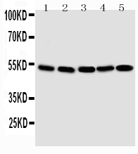 Anti-Smad1 antibody, PA2114, Western blotting Lane 1: SMMC Cell Lysate Lane 2: K562 Cell Lysate Lane 3: HT1080 Cell Lysate Lane 4: HELA Cell Lysate Lane 5: JURKAT Cell Lysate