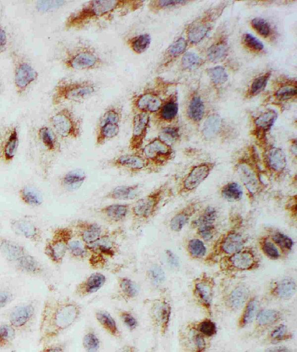 Anti-Smad1 antibody, PA2114, ICC ICC: A549 Cell