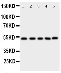 Anti-SMAD5 antibody, PA2115, Western blotting All lanes: Anti SMAD5 (PA2115) at 0.5ug/ml