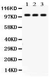 Anti-NAK antibody, PA2117, Western blotting All lanes: Anti TBK1 (PA2117) at 0.5ug/ml Lane 1: HELA Whole Cell Lysate at 40ug Lane 2: Rat Testis Tissue Lysate at 50ug Lane 3: Rat Liver Tissue Lysate at 50ug Predicted bind size: 84KD Observed bind size: 100KD