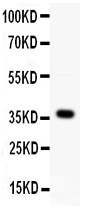 Anti-WNT4 antibody, PA2121, Western blotting All lanes: Anti WNT4 (PA2121) at 0.5ug/ml WB: MCF-7 Whole Cell Lysate at 40ug Predicted bind size: 37KD Observed bind size: 37KD