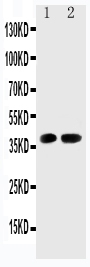 Anti-Cdk6 antibody, PA2125-2, Western blotting Lane 1: Rat Testis Tissue Lysate Lane 2: Rat Lung Tissue Lysate