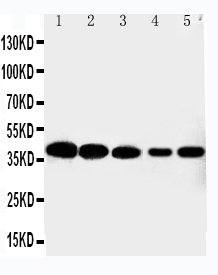 Anti-Cdk7 antibody, PA2126-1, Western blotting Lane 1: HELA Cell Lysate Lane 2: MCF-7 Cell Lysate Lane 3: A549 Cell Lysate Lane 4: COLO320 Cell Lysate Lane 5: JURKAT Cell Lysate