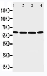 Anti-P2X6 antibody, PA2128, Western blotting Lane 1: U87 Cell Lysate Lane 2: 22RV1 Cell Lysate Lane 3: JURKAT Cell Lysate Lane 4: HT1080 Cell Lysate