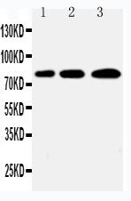 Western blot analysis of PLK2/Snk using anti-PLK2/Snk antibody (PA2131). Electrophoresis was performed on a 5-20% SDS-PAGE gel at 70V (Stacking gel) / 90V (Resolving gel) for 2-3 hours. The sample well of each lane was loaded with 50ug of sample under reducing conditions. Lane 1: A431 Cell Lysate Lane 2: 293T Cell Lysate Lane 3: COLO-320 Cell Lysate After Electrophoresis, proteins were transferred to a Nitrocellulose membrane at 150mA for 50-90 minutes. Blocked the membrane with 5% Non-fat Milk/ TBS for 1.5 hour at RT. The membrane was incubated with rabbit anti-PLK2/Snk antigen affinity purified polyclonal antibody (Catalog # PA2131) at 0.5 μg/mL overnight at 4°C, then washed with TBS-0.1%Tween 3 times with 5 minutes each and probed with a goat anti-rabbit IgG-HRP secondary antibody at a dilution of 1:10000 for 1.5 hour at RT. The signal is developed using an Enhanced Chemiluminescent detection (ECL) kit (Catalog # EK1002) with Tanon 5200 system. A specific band was detected for PLK2/Snk at approximately 78KD. The expected band size for PLK2/Snk is at 77KD.