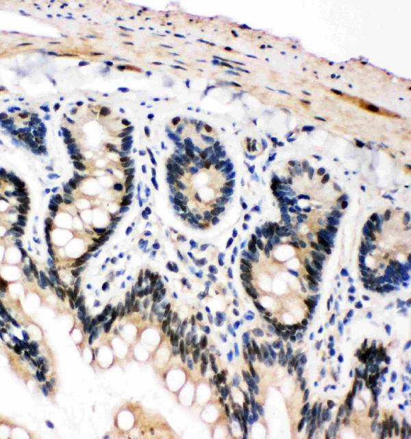 IHC analysis of PLK2/Snk using anti-PLK2/Snk antibody (PA2131). PLK2/Snk was detected in paraffin-embedded section of rat intestine tissues. Heat mediated antigen retrieval was performed in citrate buffer (pH6, epitope retrieval solution) for 20 mins. The tissue section was blocked with 10% goat serum. The tissue section was then incubated with 1μg/ml rabbit anti-PLK2/Snk Antibody (PA2131) overnight at 4°C. Biotinylated goat anti-rabbit IgG was used as secondary antibody and incubated for 30 minutes at 37°C. The tissue section was developed using Strepavidin-Biotin-Complex (SABC)(Catalog # SA1022) with DAB as the chromogen.