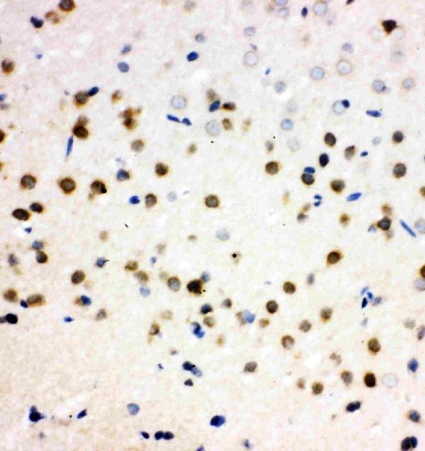 IHC analysis of PLK2/Snk using anti-PLK2/Snk antibody (PA2131). PLK2/Snk was detected in paraffin-embedded section of rat brain tissues. Heat mediated antigen retrieval was performed in citrate buffer (pH6, epitope retrieval solution) for 20 mins. The tissue section was blocked with 10% goat serum. The tissue section was then incubated with 1μg/ml rabbit anti-PLK2/Snk Antibody (PA2131) overnight at 4°C. Biotinylated goat anti-rabbit IgG was used as secondary antibody and incubated for 30 minutes at 37°C. The tissue section was developed using Strepavidin-Biotin-Complex (SABC)(Catalog # SA1022) with DAB as the chromogen.