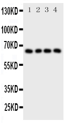 Anti-Parathyroid Hormone Receptor 1 antibody, PA2132, Western blotting All lanes: Anti Parathyroid Hormone Receptor 1 (PA2132) at 0.5ug/ml