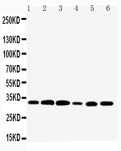 Anti-Tafazzin/TAZ antibody, PA2135, Western blotting Lane 1: Rat Skeletal Muscle Tissue Lysate Lane 2: Rat Heart Tissue Lysate Lane 3: Rat Liver Tissue Lysate Lane 4: HELA Cell Lysate Lane 5: SMMC Cell Lysate Lane 6: SCG Cell Lysate