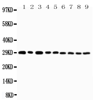 Anti-CD134/OX40 antibody, PA2136-1, Western blotting Lane 1: U87 Cell Lysate Lane 2: HELA Cell Lysate Lane 3: HT1080 Cell Lysate Lane 4: JURKAT Cell Lysate Lane 5: COLO320 Cell Lysate Lane 6: MCF-7 Cell Lysate Lane 7: SHC Cell Lysate Lane 8: COLO320 Cell Lysate