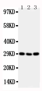 Anti-CD134/OX40 antibody, PA2136-2, Western blotting Lane 1: Mouse Brain Tissue Lysate Lane 2: Mouse Spleen Tissue Lysate Lane 3: Mouse Liver Tissue Lysate