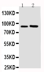 Anti-FGFR3 antibody, PA2143, Western blotting Lane 1: U87 Cell Lysate Lane 2: SGC Cell Lysate