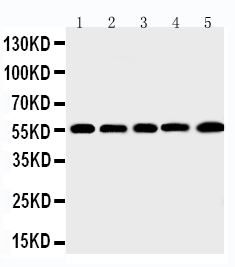 Anti-MMP12 antibody, PA2146, Western blotting Lane 1: SMMC Cell Lysate Lane 2: HEPA Cell Lysate Lane 3: HELA Cell Lysate Lane 4: K562 Cell Lysate Lane 5: MCF-7 Cell Lysate