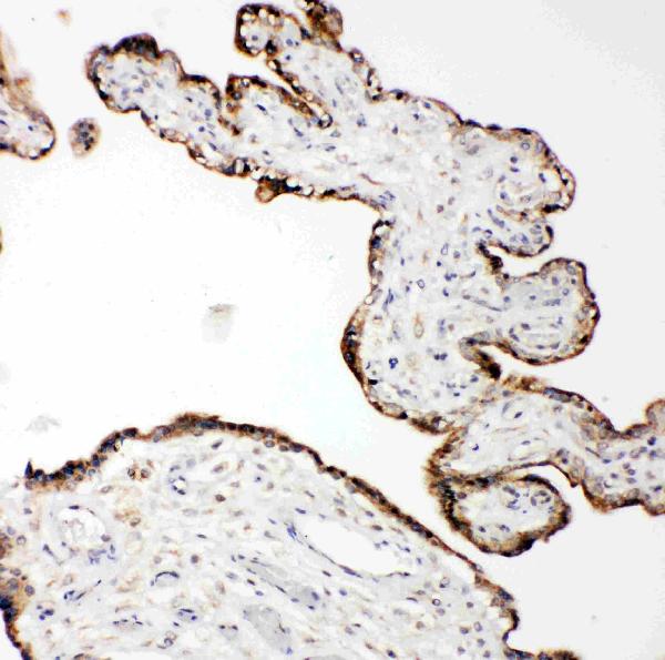 Anti-MMP14 antibody, PA2147, IHC(P) IHC(P): Human Placenta Tissue