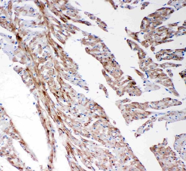 Anti-MMP14 antibody, PA2147, IHC(P) IHC(P): Rat Cardiac Muscle Tissue